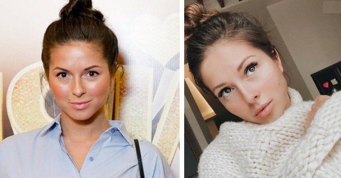 Нюша до и после пластики?