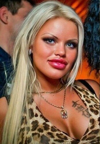 Олеся Малибу. Фото до и после пластики, операции