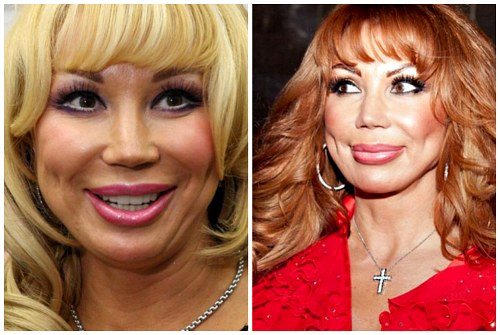 широкое лицо